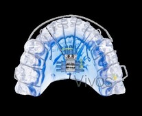 CPAP device
