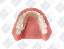 Oral sleep appliance